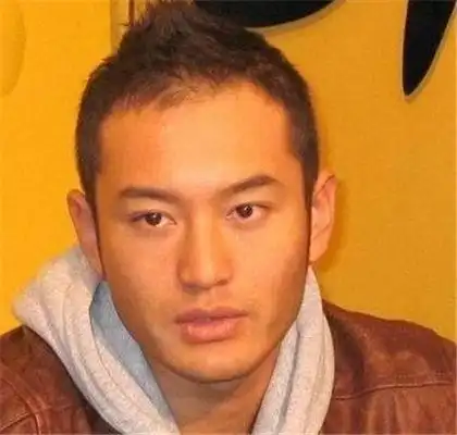 【图】黄晓明秃顶真假? 因工工作压力大承认植发