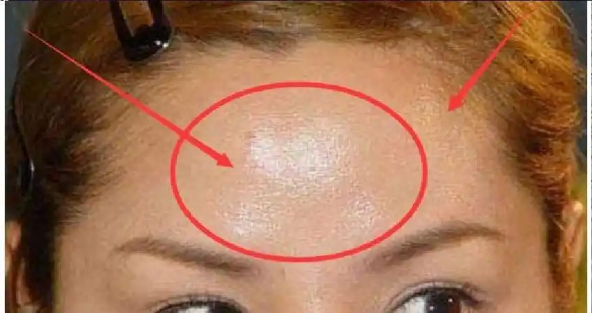 脸上出油很不清爽?教你一招,去油效果比控油护肤品都好