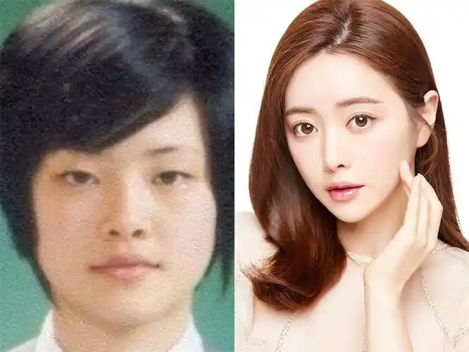 日本节目爆:「韩国99%艺人整容」引争议 5个韩国超夸张整容事件