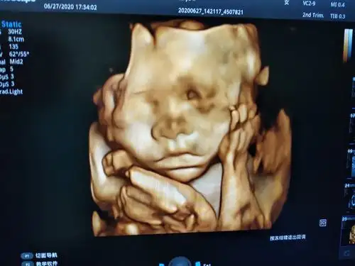 白水宏会医院——彩超室