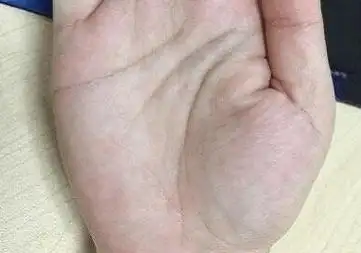 原创智慧线下垂到月丘喜欢胡思乱想遇事无主见优柔寡断