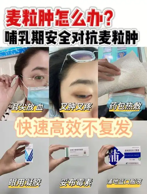 98麦粒肿反复五次74总结41566步快速消除不复发