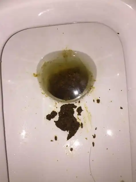没吃像猪血这样的东西,可大便颜色暗黑,有一段时间了,身体其他方面没