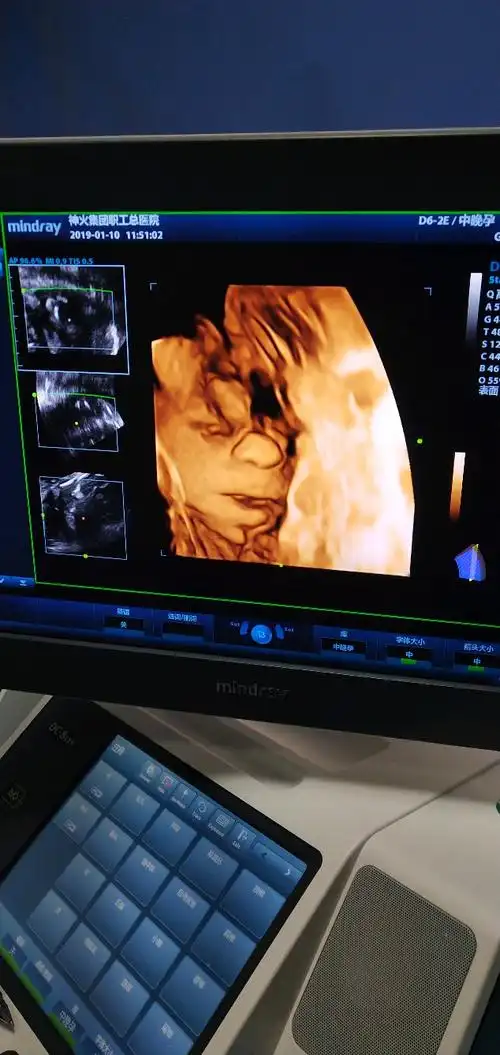 双胎小棉袄四维 我们凑成了一个好字