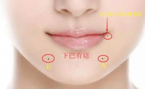 发大财的脸上痣不仅寓意好还能带给你享不尽的福气