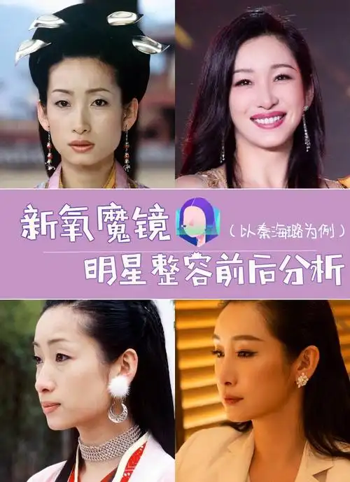 新氧魔镜明星整容前后分析以秦海璐为例