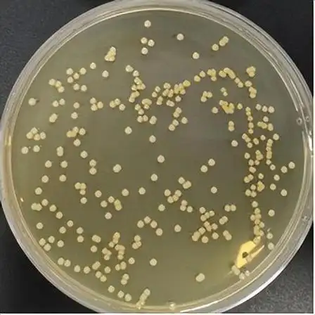 金黄色葡萄球菌(staphylococcus aureus,s.