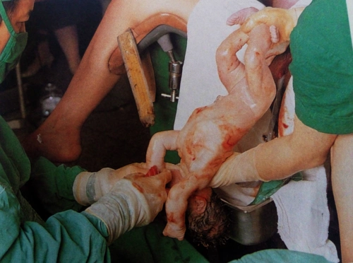 孕妇生孩子全过程真人图