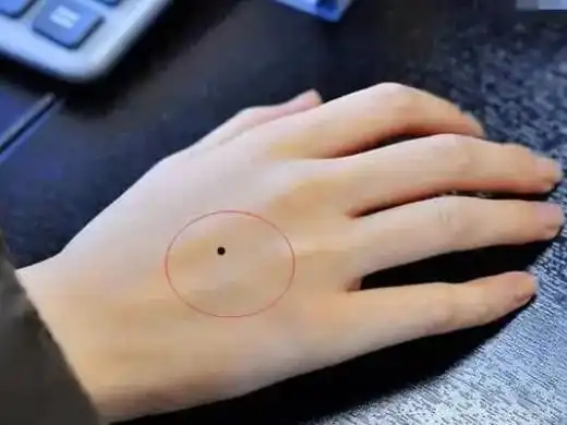 右手长痣代表什么 右手长痣有什么寓意