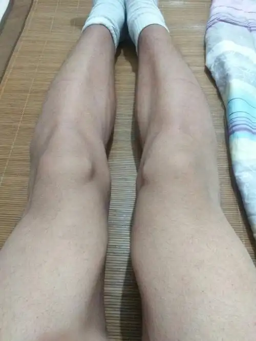 大腿肌肉为什么用力会收缩