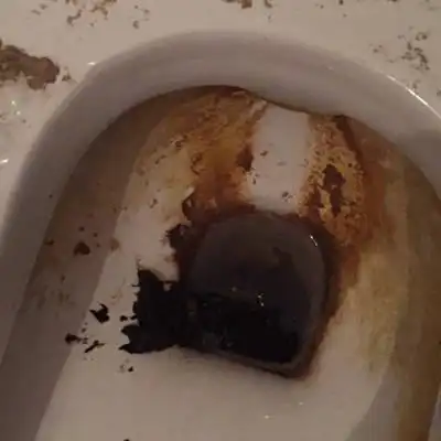 有没有和我一样情况的宝妈,孕晚期拉黑屎,还有一个礼拜就到预产期了