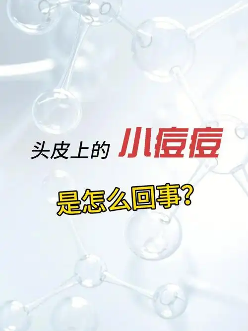 头皮上的小痘痘是怎么回事