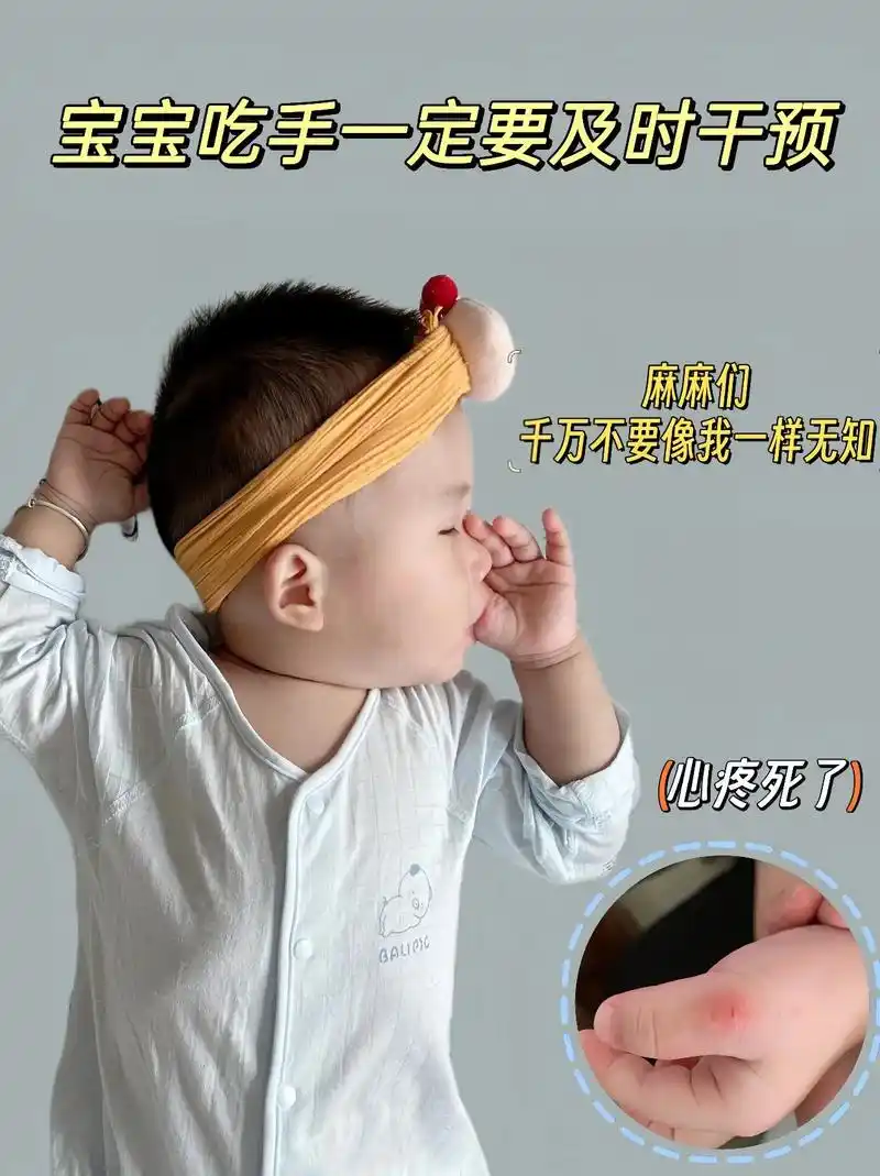 宝宝太爱吃手指了01终于找到方法戒掉了.