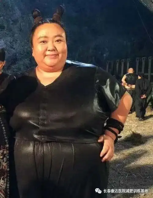 离婚女演员在长春康达减肥医院狂减180斤,自信参加相亲节目!