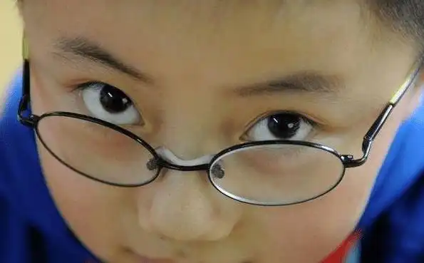 近视完全没有治愈的可能吗,好害怕小孩以后会成为深度近视,毕竟现在还