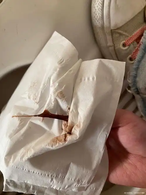 医生你好我在正常周期排卵期流了5天褐色分泌物