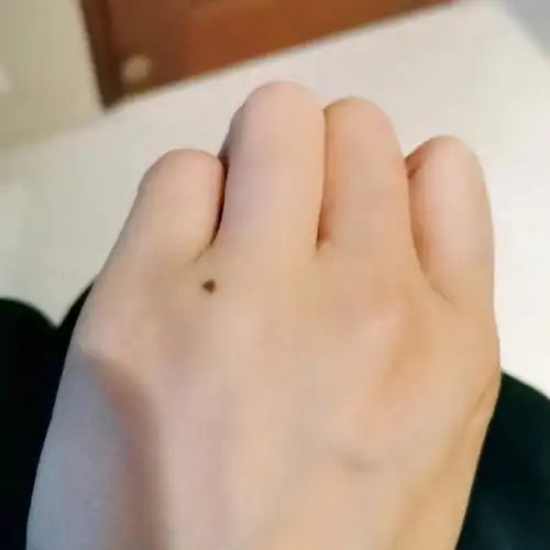 听说左手上面有一个痣这辈子有一个很爱很爱你的人