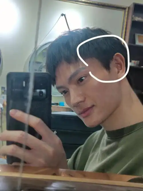 的太阳穴和我一样内凹的  就请你赶紧让他留长鬓角找托尼给做个服帖