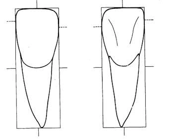 上颌中切牙的雕刻