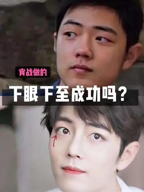 一直在新氧上有看到扒肖战整形的06开始对他的颜值只觉_圈子-新氧