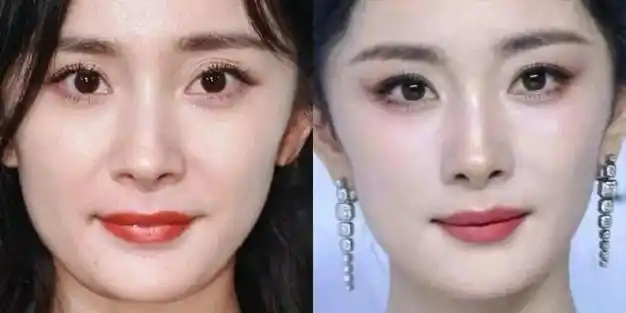 杨幂颜值大回春,她到底动了哪里?