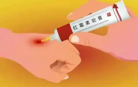 2块钱的红霉素软膏被称为"淡斑专家"?医生说出了真相_皮肤_色斑_药物