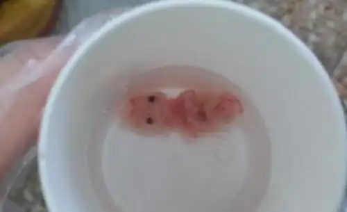 你见过60天的胎儿吗?药流后完整模样曝光,网友:太让人心疼