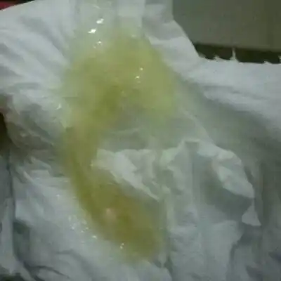 孕三十九周多,几天没有分泌物,突然出来了这样的