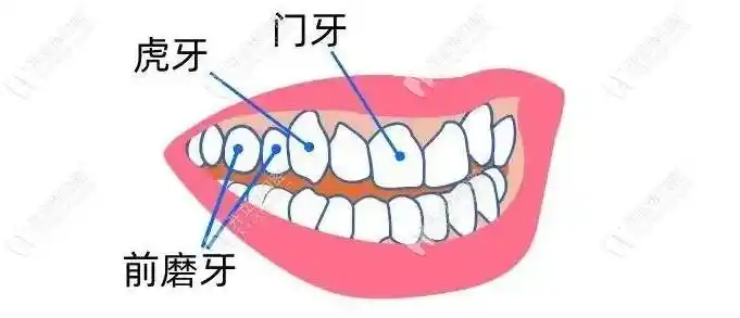 长在牙龈上的虎牙可以拔掉吗想知道如果拔掉有什么影响