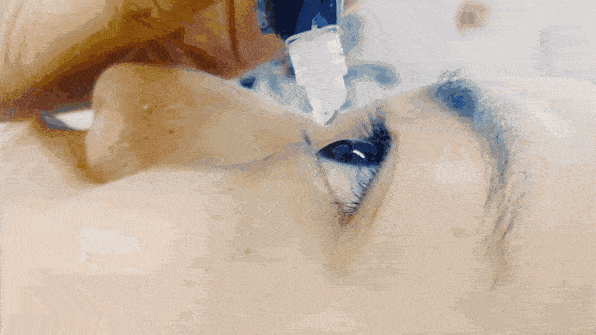 用眼疲劳危害到底有多大教你一招快速缓解