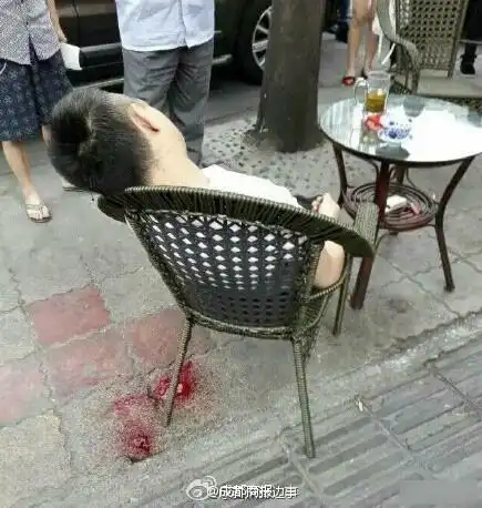 成都街头发生枪击案一男子头部中弹