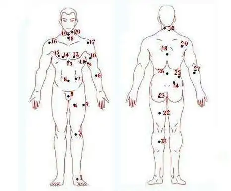 男人10处有痣是富贵痣:不同位置长痣有不同说法(图)