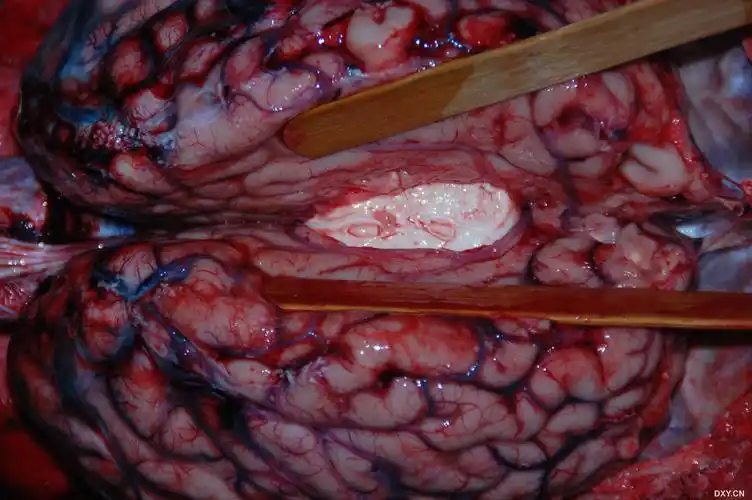 【解剖学习】很有用的尸体解剖图片