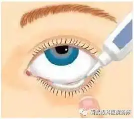 眼用制剂使用方法|眼睑|下眼睑|药液|眼药膏|结膜囊_网易订阅