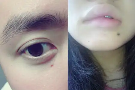 【图】妨夫痣长在什么部位 你猜不到的两个位置