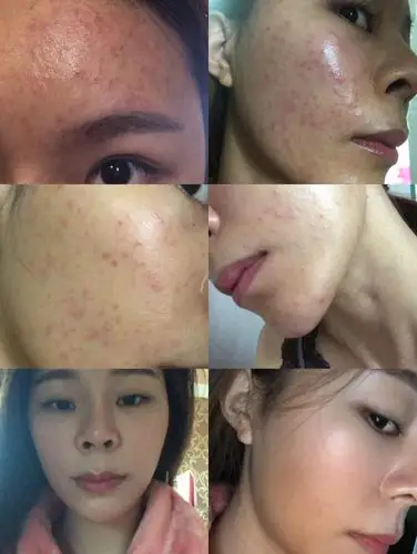 各种皮肤问题修复