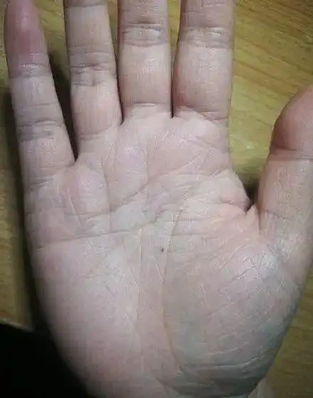 手相金星丘饱满的人