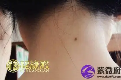 苦情痣图片 苦情痣长在哪里图解