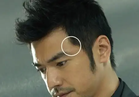 还是比较可观的现象,一般很多人都是会忽略掉头发的鬓角部位,所以对于