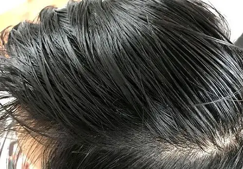 使头发打绺,有异味,引起头皮红,头屑,头痒,脱发和毛囊炎等一系列问题