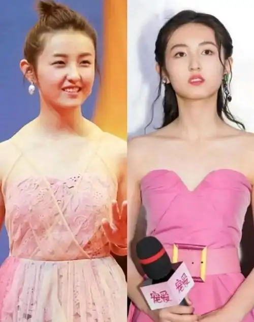 当斜方肌发达时,会带来一系列问题,如让脖子看起来短粗,脖颈线条不佳