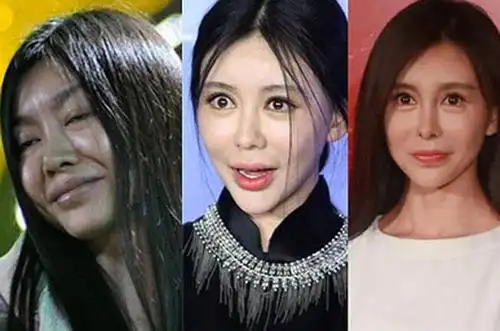 去年亮相红地毯就把观众给吓坏了,整容失败的她即使化了妆也是大小眼