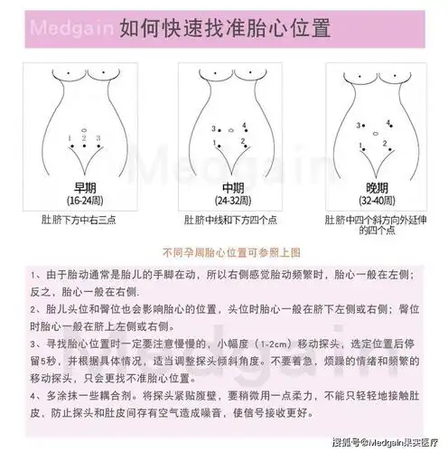 如何找准胎心位置?