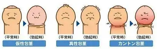 男生面对不喜欢的人,下面真的不会"有反应"吗?