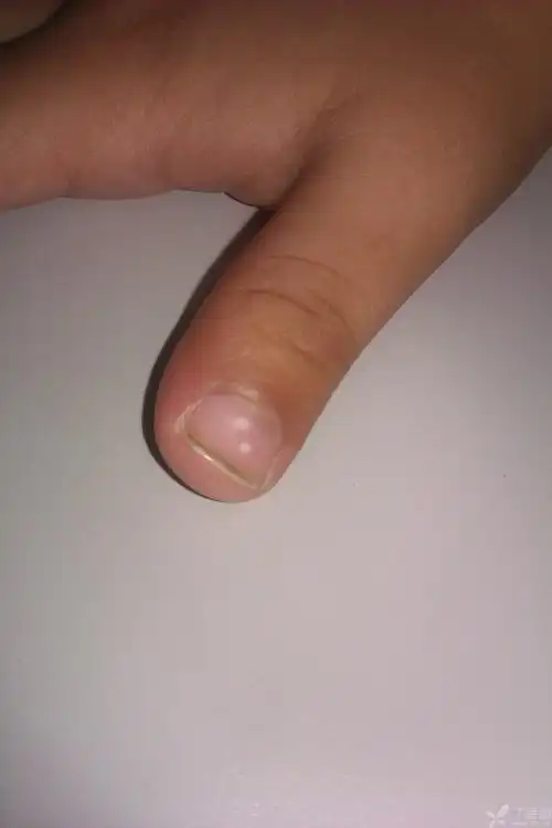 【请教】指甲上的白点,请求确诊?有图