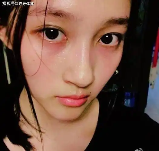 这个关晓彤卸妆后,感觉看起来五官还是很不错的,皮肤也水嫩,毕竟还很