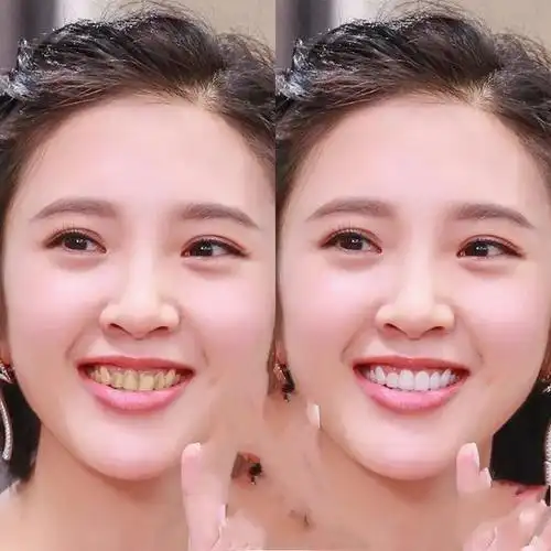 洁白牙齿图片女明星 第1页