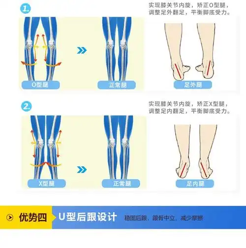 今迈龙儿童内八字外八字矫正鞋垫xo型扁平足专用鞋垫宝宝足弓支撑垫足