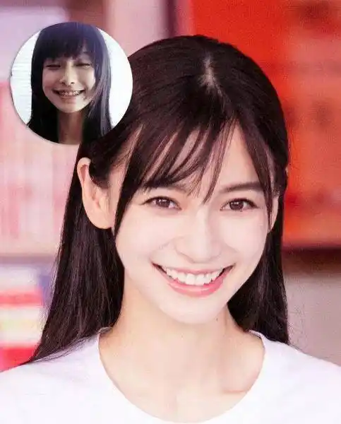 原创杨颖15岁照片曝光被网友质疑整容回应是整牙不是整容