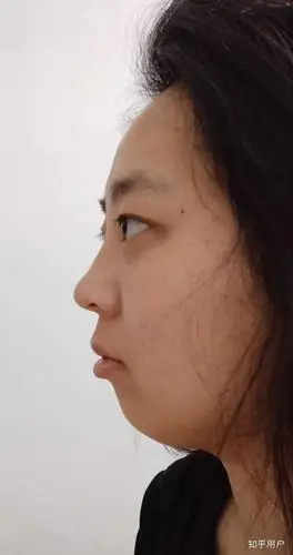 侧脸丑而正脸好看是一种什么体验?